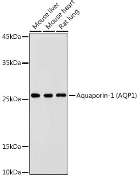 Western Blot: Aquaporin 1/AQP1 Antibody [NBP3-35493] - Western blot analysis of various lysates using Aquaporin 1/AQP1Rabbit pAb at 1:500 dilution.Secondary antibody: HRP-conjugated Goat anti-Rabbit IgG (H+L) at 1:10000 dilution.Lysates/proteins: 25ug per lane.Blocking buffer: 3% nonfat dry milk in TBST.Detection: ECL Basic Kit.Exposure time: 180s.