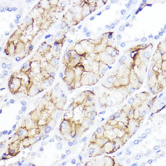 Immunohistochemistry: Aquaporin 1/AQP1 Antibody [NBP3-35493] - Immunohistochemistry analysis of paraffin-embedded Human kidney using Aquaporin 1/AQP1Rabbit pAb at dilution of 1:100 (40x lens). High pressure antigen retrieval performed with 0.01M Citrate Bufferr (pH 6.0) prior to IHC staining.