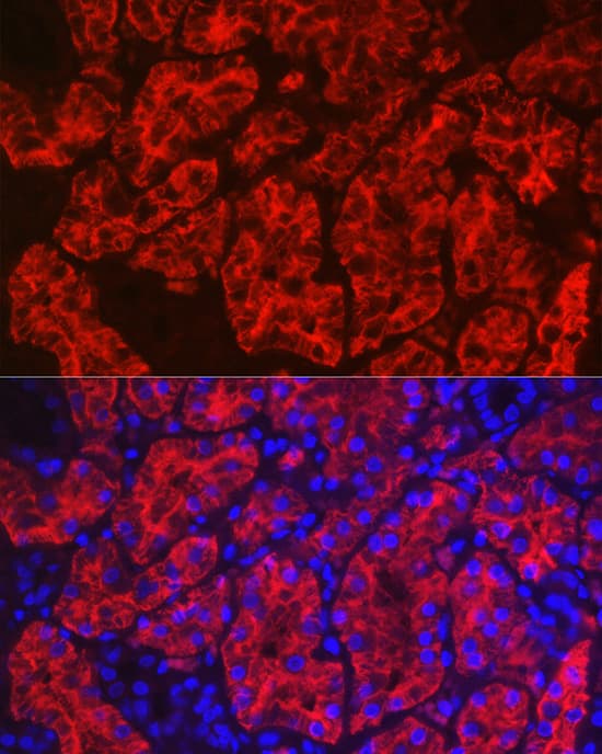 Immunocytochemistry/ Immunofluorescence: Aquaporin 1/AQP1 Antibody [NBP3-35493] - Immunofluorescence analysis of paraffin-embedded human kidney using Aquaporin 1/AQP1Rabbit pAb at dilution of 1:100 (40x lens). Secondary antibody: Cy3-conjugated Goat anti-Rabbit IgG (H+L) at 1:500 dilution. Blue: DAPI for nuclear staining.