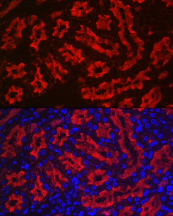 Immunocytochemistry/ Immunofluorescence: Aquaporin 1/AQP1 Antibody [NBP3-35493] - Immunofluorescence analysis of paraffin-embedded rat kidney using Aquaporin 1/AQP1Rabbit pAb at dilution of 1:100 (40x lens). Secondary antibody: Cy3-conjugated Goat anti-Rabbit IgG (H+L) at 1:500 dilution. Blue: DAPI for nuclear staining.