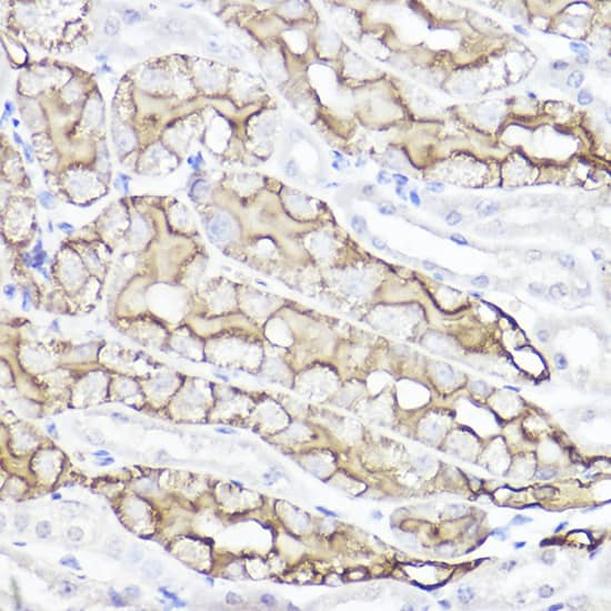 Immunohistochemistry: Aquaporin 1/AQP1 Antibody [NBP3-35493] - Immunohistochemistry analysis of paraffin-embedded Mouse kidney using Aquaporin 1/AQP1Rabbit pAb at dilution of 1:100 (40x lens). High pressure antigen retrieval performed with 0.01M Citrate Bufferr (pH 6.0) prior to IHC staining.