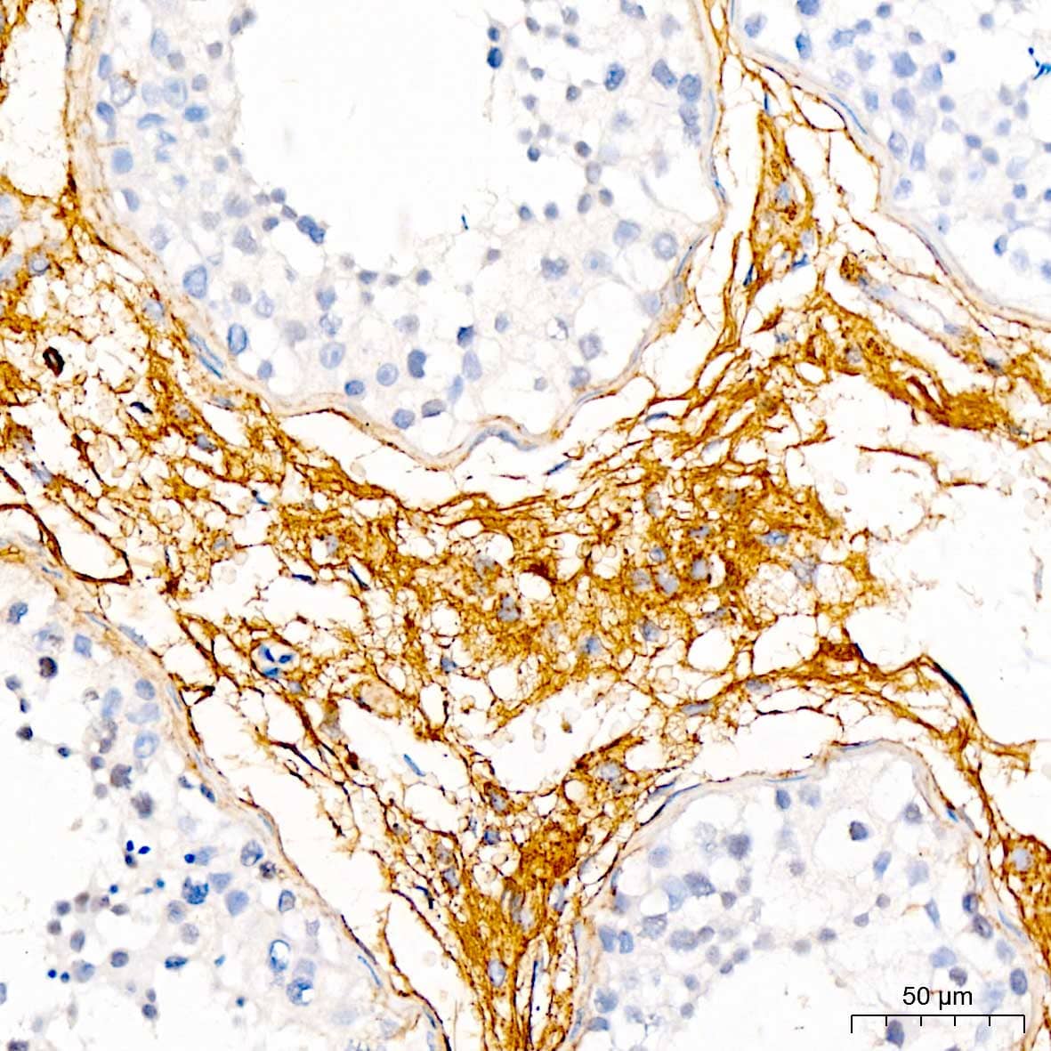 Immunohistochemistry: Decorin Neo Antibody [NBP3-35494] - Immunohistochemistry analysis of paraffin-embedded Human testis using Decorin Neo Rabbit pAb at dilution of 1:50 (40x lens). High pressure antigen retrieval performed with 0.01M Citrate Bufferr (pH 6.0) prior to IHC staining.