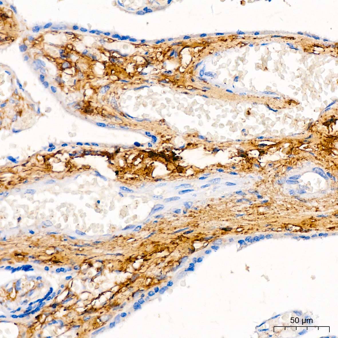 Immunohistochemistry: Decorin Neo Antibody [NBP3-35494] - Immunohistochemistry analysis of paraffin-embedded Human placenta using Decorin Neo Rabbit pAb at dilution of 1:50 (40x lens). High pressure antigen retrieval performed with 0.01M Citrate Bufferr (pH 6.0) prior to IHC staining.