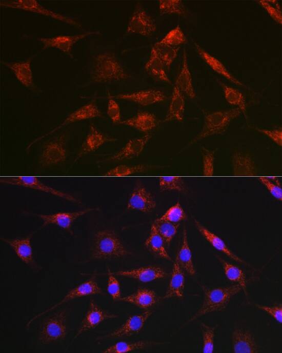 Immunocytochemistry/ Immunofluorescence: Decorin Neo Antibody [NBP3-35494] - Immunofluorescence analysis of NIH-3T3 cells using Decorin Neo Rabbit pAb at dilution of 1:100 (40x lens). Secondary antibody: Cy3-conjugated Goat anti-Rabbit IgG (H+L) at 1:500 dilution. Blue: DAPI for nuclear staining.