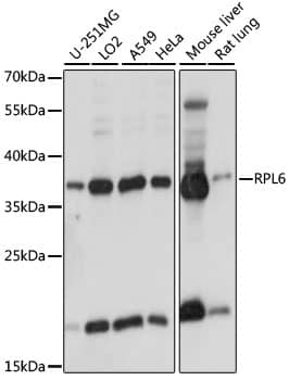 Western Blot: RPL6 Antibody [NBP3-35496] - Western blot analysis of various lysates using RPL6 Rabbit pAb at 1:1000 dilution.Secondary antibody: HRP-conjugated Goat anti-Rabbit IgG (H+L) at 1:10000 dilution.Lysates/proteins: 25ug per lane.Blocking buffer: 3% nonfat dry milk in TBST.Detection: ECL Basic Kit.Exposure time: 1s.