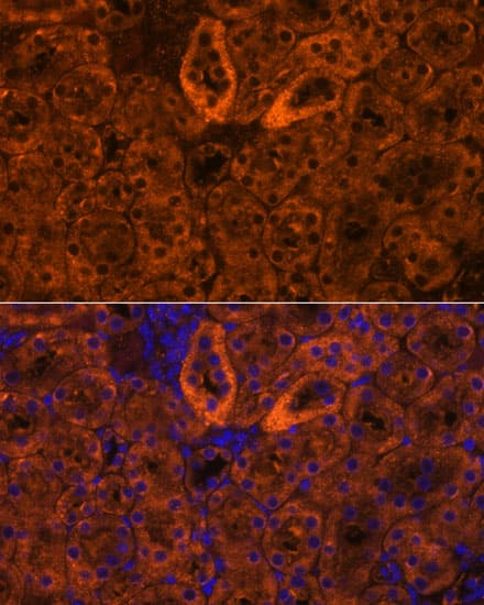 Immunocytochemistry/ Immunofluorescence: epithelial Sodium Channel gamma Antibody [NBP3-35497] - Immunofluorescence analysis of paraffin-embedded mouse kidney using epithelial Sodium Channel gamma Rabbit pAb at dilution of 1:100. Secondary antibody: Cy3-conjugated Goat anti-Rabbit IgG (H+L) at 1:500 dilution. Blue: DAPI for nuclear staining.