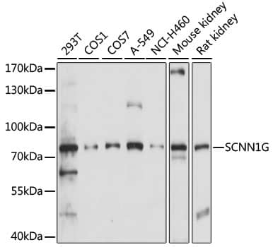 Western Blot: epithelial Sodium Channel gamma Antibody [NBP3-35497] - Western blot analysis of various lysates using epithelial Sodium Channel gamma Rabbit pAb at 1:1000 dilution.Secondary antibody: HRP-conjugated Goat anti-Rabbit IgG (H+L) at 1:10000 dilution.Lysates/proteins: 25ug per lane.Blocking buffer: 3% nonfat dry milk in TBST.Detection: ECL Basic Kit.Exposure time: 30s.