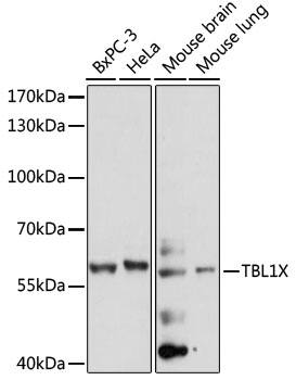 Western Blot: TBL1 Antibody [NBP3-35499] - Western blot analysis of various lysates using TBL1 Rabbit pAb at 1:1000 dilution.Secondary antibody: HRP-conjugated Goat anti-Rabbit IgG (H+L) at 1:10000 dilution.Lysates/proteins: 25ug per lane.Blocking buffer: 3% nonfat dry milk in TBST.Detection: ECL Basic Kit.Exposure time: 60s.