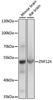 Western Blot: ZNF124 Antibody [NBP3-35500] - Western blot analysis of various lysates using ZNF124 Rabbit pAb at 1:1000 dilution.Secondary antibody: HRP-conjugated Goat anti-Rabbit IgG (H+L) at 1:10000 dilution.Lysates/proteins: 25ug per lane.Blocking buffer: 3% nonfat dry milk in TBST.Detection: ECL Basic Kit.Exposure time: 1s.