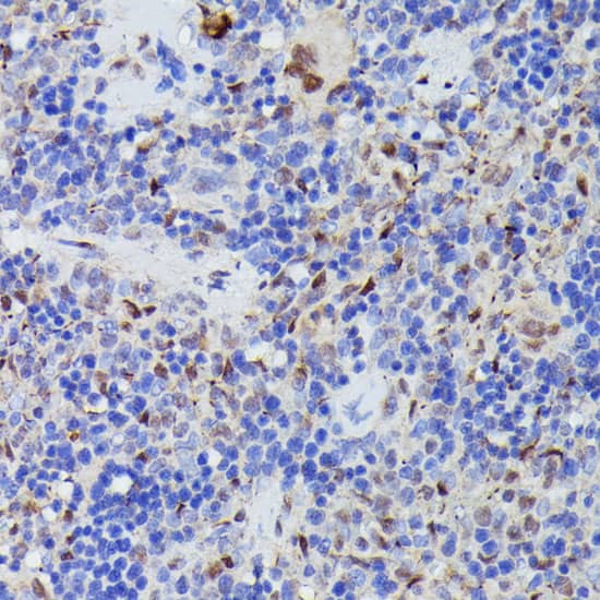 Immunohistochemistry: Cdc23 Antibody [NBP3-35501] - Immunohistochemistry analysis of paraffin-embedded Rat spleen using Cdc23 Rabbit pAb at dilution of 1:100 (40x lens). Microwave antigen retrieval performed with 0.01M PBS Buffer (pH 7.2) prior to IHC staining.