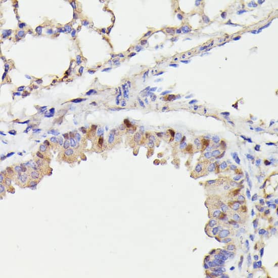 Immunohistochemistry Cdc23 Antibody