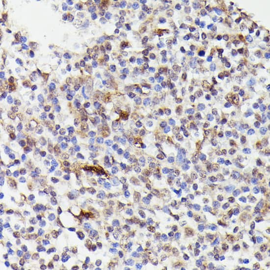 Immunohistochemistry: Cdc23 Antibody [NBP3-35501] - Immunohistochemistry analysis of paraffin-embedded Human tonsil using Cdc23 Rabbit pAb at dilution of 1:100 (40x lens). Microwave antigen retrieval performed with 0.01M PBS Buffer (pH 7.2) prior to IHC staining.