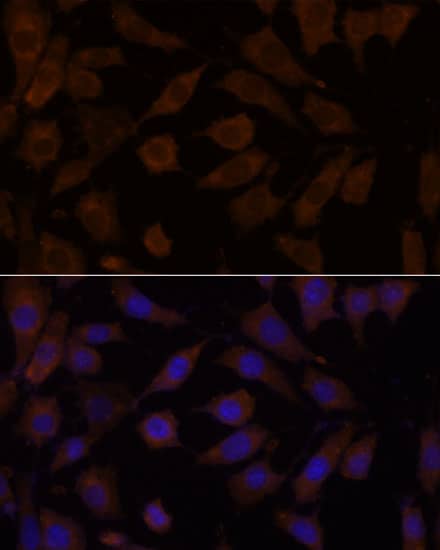 Immunocytochemistry/ Immunofluorescence: OXSR1 Antibody [NBP3-35502] - Immunofluorescence analysis of L929 cells using OXSR1 Rabbit pAb at dilution of 1:100. Secondary antibody: Cy3-conjugated Goat anti-Rabbit IgG (H+L) at 1:500 dilution. Blue: DAPI for nuclear staining.