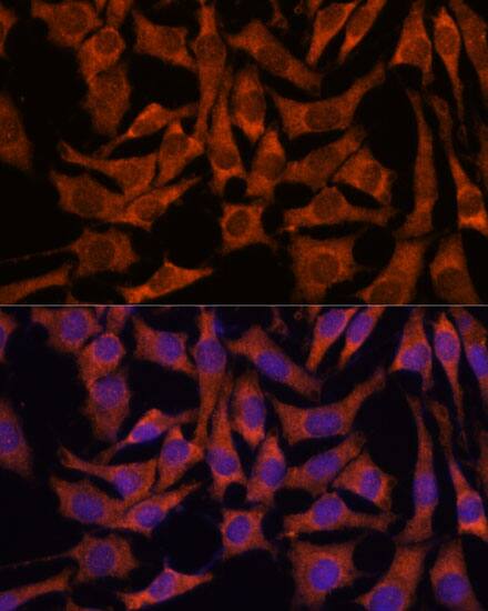 Immunocytochemistry/ Immunofluorescence: SEC23B Antibody [NBP3-35503] - Immunofluorescence analysis of L929 cells using SEC23B Rabbit pAb at dilution of 1:100. Secondary antibody: Cy3-conjugated Goat anti-Rabbit IgG (H+L) at 1:500 dilution. Blue: DAPI for nuclear staining.