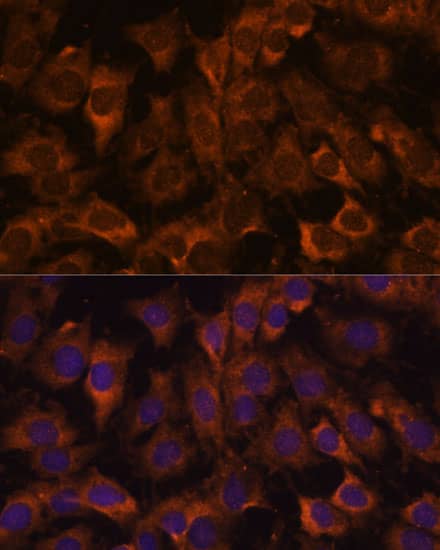 Immunocytochemistry/ Immunofluorescence: SEC23B Antibody [NBP3-35503] - Immunofluorescence analysis of C6 cells using SEC23B Rabbit pAb at dilution of 1:100. Secondary antibody: Cy3-conjugated Goat anti-Rabbit IgG (H+L) at 1:500 dilution. Blue: DAPI for nuclear staining.