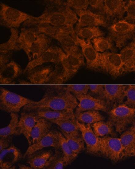 Immunocytochemistry/ Immunofluorescence: SEC23B Antibody [NBP3-35503] - Immunofluorescence analysis of U-2 OS cells using SEC23B Rabbit pAb at dilution of 1:100. Secondary antibody: Cy3-conjugated Goat anti-Rabbit IgG (H+L) at 1:500 dilution. Blue: DAPI for nuclear staining.