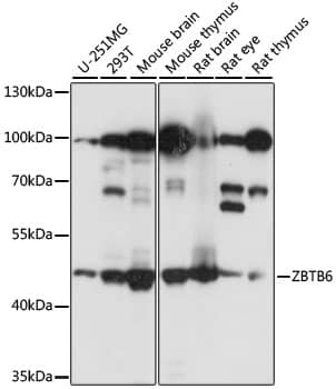 Western Blot ZBTB6 Antibody - BSA Free