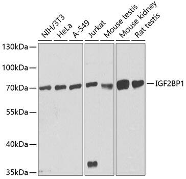 Western Blot: IGF2BP1 Antibody [NBP3-35508] - Western blot analysis of various lysates using IGF2BP1 Rabbit pAb at 1:1000 dilution.Secondary antibody: HRP-conjugated Goat anti-Rabbit IgG (H+L) at 1:10000 dilution.Lysates/proteins: 25ug per lane.Blocking buffer: 3% nonfat dry milk in TBST.Detection: ECL Basic Kit.Exposure time: 90s.