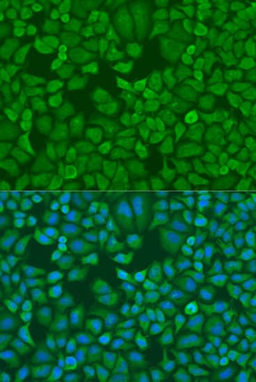 Immunocytochemistry/ Immunofluorescence: IGF2BP1 Antibody [NBP3-35508] - Immunofluorescence analysis of U2OS cells using IGF2BP1 Rabbit pAb at dilution of 1:100. Secondary antibody: Cy3-conjugated Goat anti-Rabbit IgG (H+L) at 1:500 dilution. Blue: DAPI for nuclear staining.