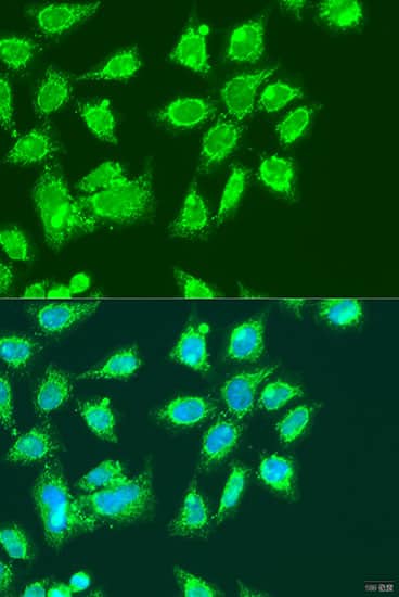 Immunocytochemistry/ Immunofluorescence: MCCC2 Antibody [NBP3-35509] - Immunofluorescence analysis of U2OS cells using MCCC2 Rabbit pAb at dilution of 1:100. Secondary antibody: Cy3-conjugated Goat anti-Rabbit IgG (H+L) at 1:500 dilution. Blue: DAPI for nuclear staining.
