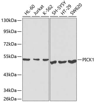 Western Blot: PICK1 Antibody [NBP3-35510] - Western blot analysis of various lysates using PICK1 Rabbit pAb at 1:1000 dilution.Secondary antibody: HRP-conjugated Goat anti-Rabbit IgG (H+L) at 1:10000 dilution.Lysates/proteins: 25ug per lane.Blocking buffer: 3% nonfat dry milk in TBST.