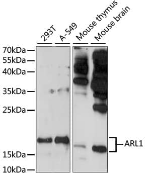 Western Blot: ARL1 Antibody [NBP3-35519] - Western blot analysis of various lysates using ARL1 Rabbit pAb at 1:1000 dilution.Secondary antibody: HRP-conjugated Goat anti-Rabbit IgG (H+L) at 1:10000 dilution.Lysates/proteins: 25ug per lane.Blocking buffer: 3% nonfat dry milk in TBST.Detection: ECL Basic Kit.Exposure time: 3min.