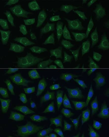 Immunocytochemistry/ Immunofluorescence: ARL1 Antibody [NBP3-35519] - Immunofluorescence analysis of L929 cells using ARL1 Rabbit pAb at dilution of 1:100 (40x lens). Secondary antibody: Cy3-conjugated Goat anti-Rabbit IgG (H+L) at 1:500 dilution. Blue: DAPI for nuclear staining.