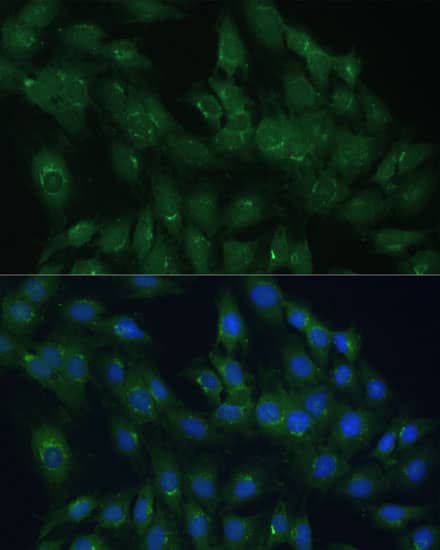 Immunocytochemistry/ Immunofluorescence: ARL1 Antibody [NBP3-35519] - Immunofluorescence analysis of C6 cells using ARL1 Rabbit pAb at dilution of 1:100 (40x lens). Secondary antibody: Cy3-conjugated Goat anti-Rabbit IgG (H+L) at 1:500 dilution. Blue: DAPI for nuclear staining.