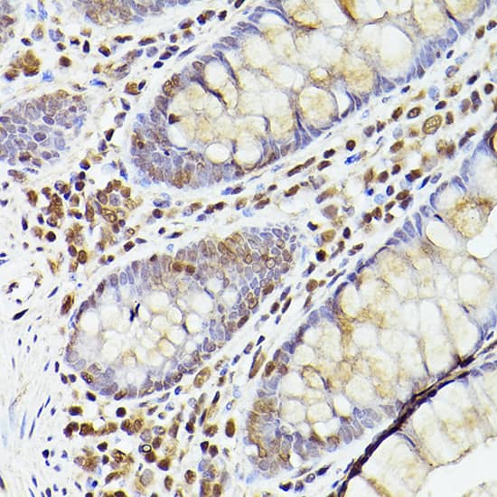 Immunohistochemistry: TET2 Antibody [NBP3-35520] - Immunohistochemistry analysis of paraffin-embedded Human colon using TET2 Rabbit pAb at dilution of 1:100 (40x lens). High pressure antigen retrieval performed with 0.01M Citrate Bufferr (pH 6.0) prior to IHC staining.