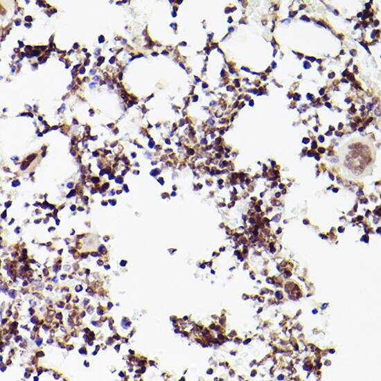 Immunohistochemistry: TET2 Antibody [NBP3-35520] - Immunohistochemistry analysis of paraffin-embedded Rat bone marrow using TET2 Rabbit pAb at dilution of 1:100 (40x lens). High pressure antigen retrieval performed with 0.01M Citrate Bufferr (pH 6.0) prior to IHC staining.