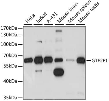 Western Blot: TFIIE-alpha Antibody [NBP3-35521] - Western blot analysis of various lysates using TFIIE-alpha Rabbit pAb at 1:1000 dilution.Secondary antibody: HRP-conjugated Goat anti-Rabbit IgG (H+L) at 1:10000 dilution.Lysates/proteins: 25ug per lane.Blocking buffer: 3% nonfat dry milk in TBST.Detection: ECL Basic Kit.Exposure time: 5S.