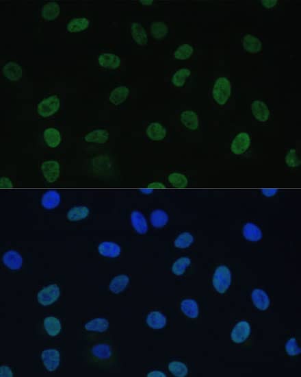 Immunocytochemistry/ Immunofluorescence TFIIE-alpha Antibody - BSA Free
