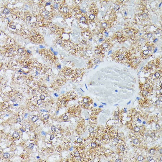 Immunohistochemistry: IVD Antibody [NBP3-35522] - Immunohistochemistry analysis of paraffin-embedded Rat liver using IVD Rabbit pAb at dilution of 1:100 (40x lens). Microwave antigen retrieval performed with 0.01M PBS Buffer (pH 7.2) prior to IHC staining.