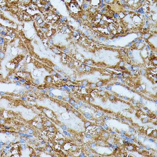 Immunohistochemistry: IVD Antibody [NBP3-35522] - Immunohistochemistry analysis of paraffin-embedded Mouse kidney using IVD Rabbit pAb at dilution of 1:100 (40x lens). Microwave antigen retrieval performed with 0.01M PBS Buffer (pH 7.2) prior to IHC staining.