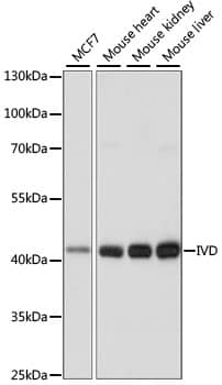 Western Blot: IVD Antibody [NBP3-35522] - Western blot analysis of various lysates using IVD Rabbit pAb at 1:1000 dilution.Secondary antibody: HRP-conjugated Goat anti-Rabbit IgG (H+L) at 1:10000 dilution.Lysates/proteins: 25ug per lane.Blocking buffer: 3% nonfat dry milk in TBST.Detection: ECL Basic Kit.Exposure time: 1S.