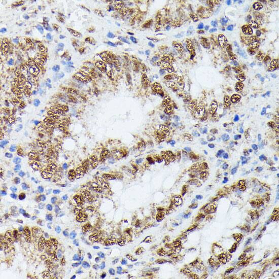 Immunohistochemistry: KIF22 Antibody [NBP3-35523] - Immunohistochemistry analysis of paraffin-embedded Human colon using KIF22 Rabbit pAb at dilution of 1:100 (40x lens). Microwave antigen retrieval performed with 0.01M PBS Buffer (pH 7.2) prior to IHC staining.