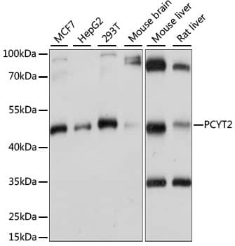 Western Blot: PCYT2 Antibody [NBP3-35527] - Western blot analysis of various lysates using PCYT2 Rabbit pAb at 1:1000 dilution.Secondary antibody: HRP-conjugated Goat anti-Rabbit IgG (H+L) at 1:10000 dilution.Lysates/proteins: 25ug per lane.Blocking buffer: 3% nonfat dry milk in TBST.Detection: ECL Basic Kit.Exposure time: 1s.