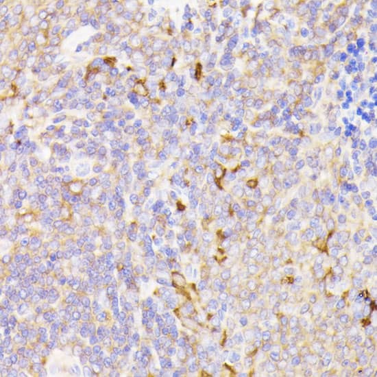 Immunohistochemistry: PSMG1 Antibody [NBP3-35530] - Immunohistochemistry analysis of paraffin-embedded Rat spleen using PSMG1 Rabbit pAb at dilution of 1:100 (40x lens). Microwave antigen retrieval performed with 0.01M PBS Buffer (pH 7.2) prior to IHC staining.