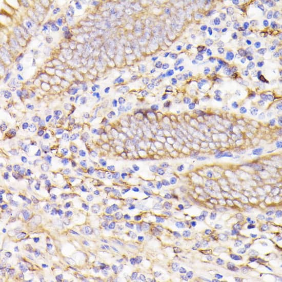 Immunohistochemistry: PSMG1 Antibody [NBP3-35530] - Immunohistochemistry analysis of paraffin-embedded Human appendix using PSMG1 Rabbit pAb at dilution of 1:100 (40x lens). Microwave antigen retrieval performed with 0.01M PBS Buffer (pH 7.2) prior to IHC staining.