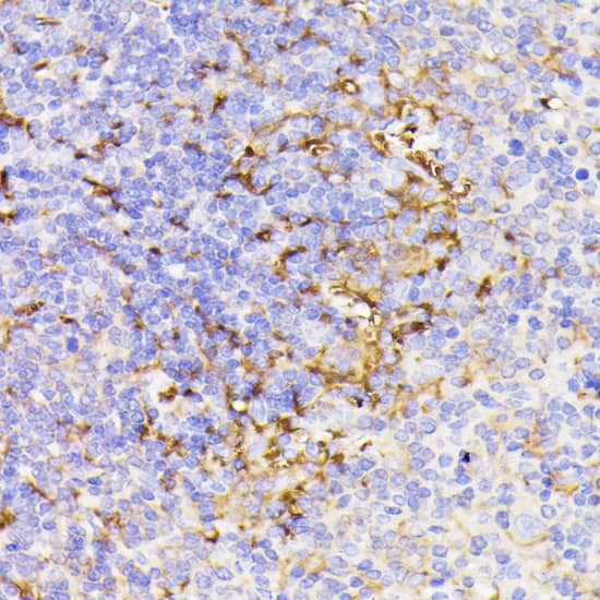 Immunohistochemistry: PSMG1 Antibody [NBP3-35530] - Immunohistochemistry analysis of paraffin-embedded Mouse spleen using PSMG1 Rabbit pAb at dilution of 1:100 (40x lens). Microwave antigen retrieval performed with 0.01M PBS Buffer (pH 7.2) prior to IHC staining.