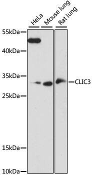 Western Blot: CLIC3 Antibody [NBP3-35532] - Western blot analysis of various lysates using CLIC3 Rabbit pAb at 1:1000 dilution.Secondary antibody: HRP-conjugated Goat anti-Rabbit IgG (H+L) at 1:10000 dilution.Lysates/proteins: 25ug per lane.Blocking buffer: 3% nonfat dry milk in TBST.Detection: ECL Basic Kit.Exposure time: 90s.