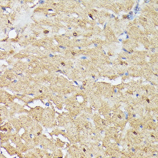 Immunohistochemistry: ASC1 Antibody [NBP3-35533] - Immunohistochemistry analysis of paraffin-embedded Rat heart using ASC1 Rabbit pAb at dilution of 1:100 (40x lens). Microwave antigen retrieval performed with 0.01M PBS Buffer (pH 7.2) prior to IHC staining.