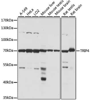 Western Blot ASC1 Antibody