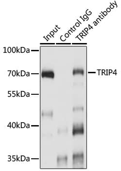 Immunoprecipitation: ASC1 Antibody [NBP3-35533] - Immunoprecipitation analysis of 200 ug extracts of A-549 cells using 3 ug ASC1 antibody. Western blot was performed from the immunoprecipitate using ASC1 antibody at a dilution of 1:1000.