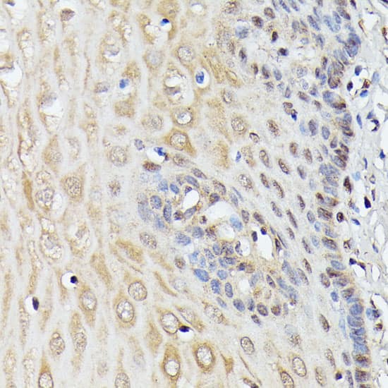 Immunohistochemistry: ASC1 Antibody [NBP3-35533] - Immunohistochemistry analysis of paraffin-embedded Human esophageal using ASC1 Rabbit pAb at dilution of 1:100 (40x lens). Microwave antigen retrieval performed with 0.01M PBS Buffer (pH 7.2) prior to IHC staining.