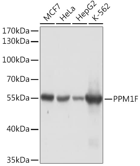 Western Blot: Protein phosphatase 1F Antibody [NBP3-35535] - Western blot analysis of various lysates using Protein phosphatase 1F Rabbit pAb at 1:1000 dilution.Secondary antibody: HRP-conjugated Goat anti-Rabbit IgG (H+L) at 1:10000 dilution.Lysates/proteins: 25ug per lane.Blocking buffer: 3% nonfat dry milk in TBST.Detection: ECL Basic Kit.Exposure time: 10s.