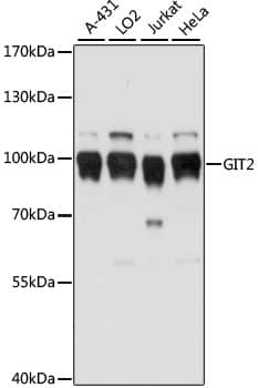 Western Blot: GIT2 Antibody [NBP3-35536] - Western blot analysis of various lysates using GIT2 Rabbit pAb at 1:1000 dilution.Secondary antibody: HRP-conjugated Goat anti-Rabbit IgG (H+L) at 1:10000 dilution.Lysates/proteins: 25ug per lane.Blocking buffer: 3% nonfat dry milk in TBST.Detection: ECL Basic Kit.Exposure time: 1s.