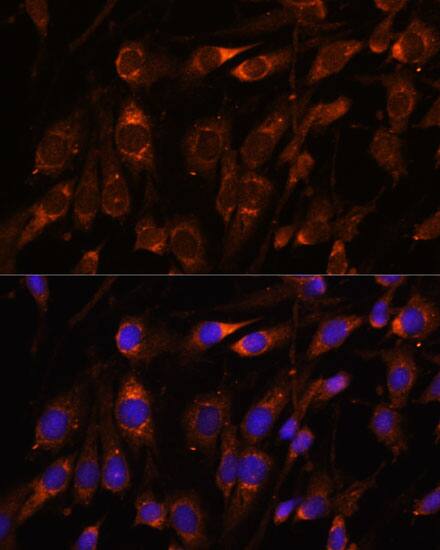 Immunocytochemistry/ Immunofluorescence: FARSB Antibody [NBP3-35538] - Immunofluorescence analysis of C6 cells using FARSB Rabbit pAb at dilution of 1:100. Secondary antibody: Cy3-conjugated Goat anti-Rabbit IgG (H+L) at 1:500 dilution. Blue: DAPI for nuclear staining.