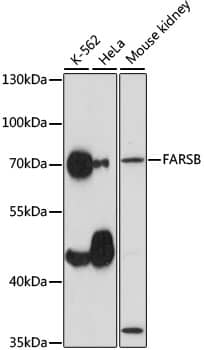 Western Blot: FARSB Antibody [NBP3-35538] - Western blot analysis of various lysates using FARSB Rabbit pAb at 1:1000 dilution.Secondary antibody: HRP-conjugated Goat anti-Rabbit IgG (H+L) at 1:10000 dilution.Lysates/proteins: 25ug per lane.Blocking buffer: 3% nonfat dry milk in TBST.Detection: ECL Basic Kit.Exposure time: 30s.