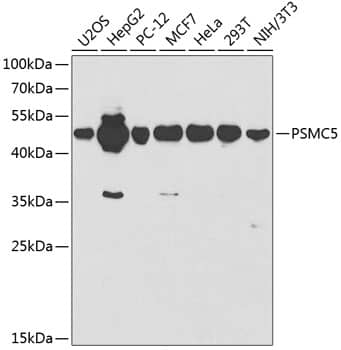 Western Blot: SUG1 Antibody [NBP3-35540] - Western blot analysis of various lysates using SUG1 Rabbit pAb at 1:1000 dilution.Secondary antibody: HRP-conjugated Goat anti-Rabbit IgG (H+L) at 1:10000 dilution.Lysates/proteins: 25ug per lane.Blocking buffer: 3% nonfat dry milk in TBST.